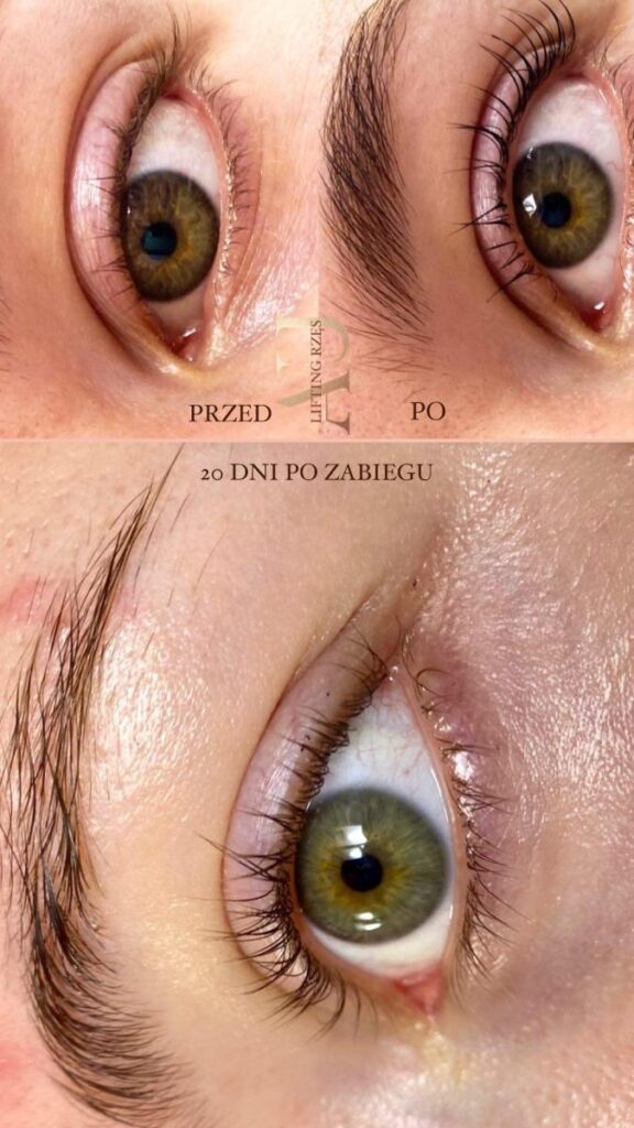 lifting_rzes_dni_po